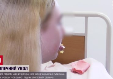 Хотіла збільшити: у Дніпрі 14-річна школярка вколола собі в губи олію та потрапила на операційний стіл (ВІДЕО)