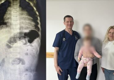 Заколка в шлунку: у Мукачеві лікарі провели рідкісну операцію немовляті
