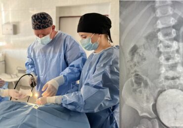 У Закарпатській дитячій лікарні прооперували 4-річну дівчинку з рідкісною вадою нирок