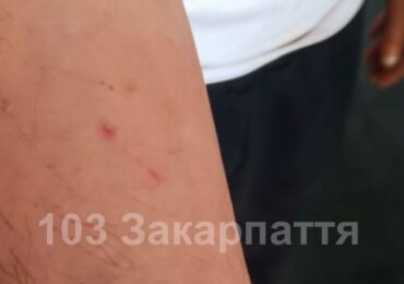 На Тячівщині чоловіка госпіталізували з підозрою на укус змії