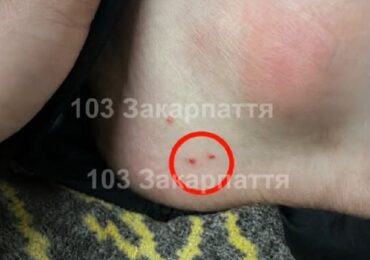 На Тячівщині 61-річного чоловіка госпіталізували після укусу отруйної змії