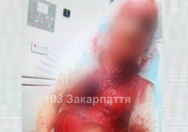 В Ужгороді домашній собака покусав 60-річного чоловіка